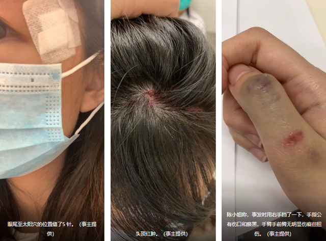 无人机击中女子案后续 警方拘捕33岁男子