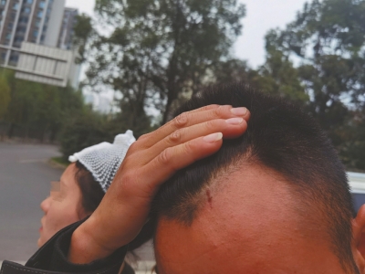 天降无人机 砸伤看表演的夫妻俩